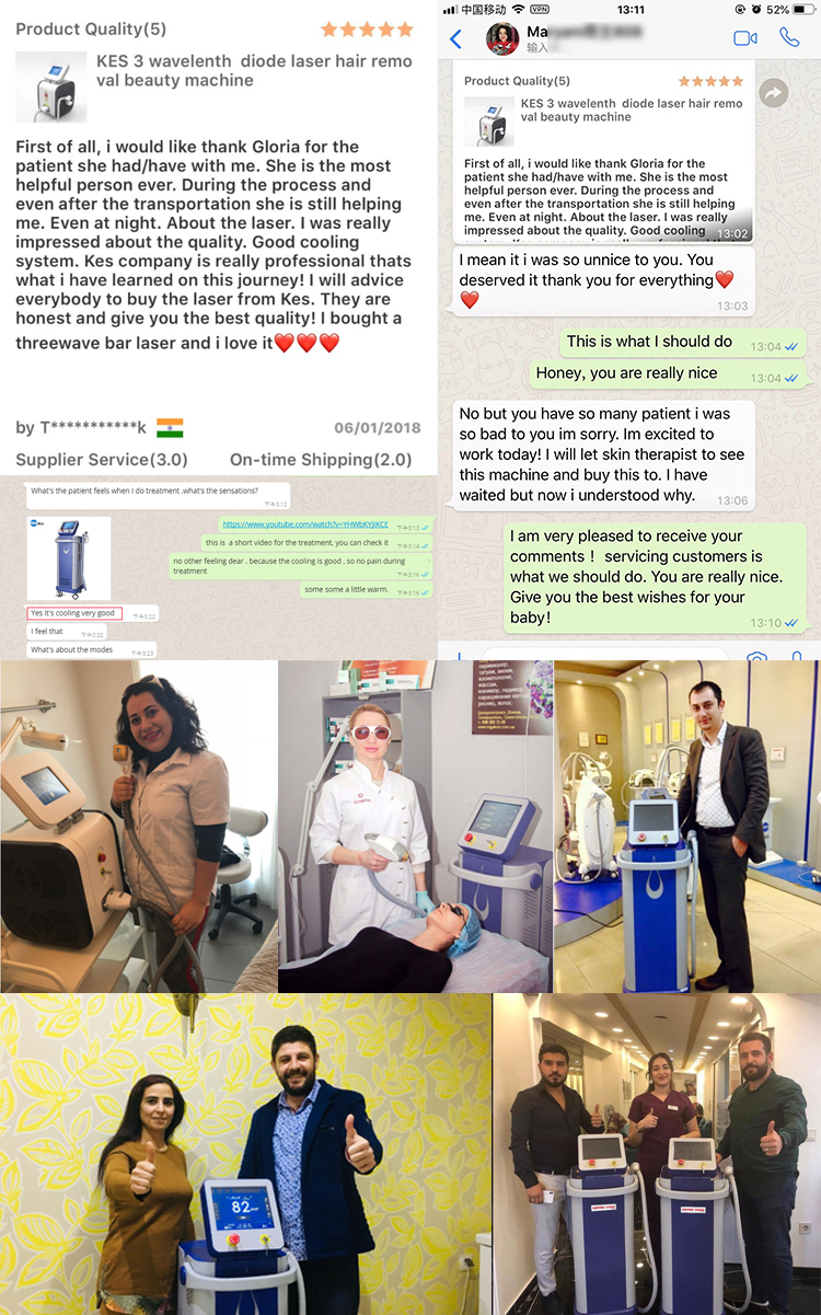 2022 top selling hair removal epilation diode laser hair removal machine laser