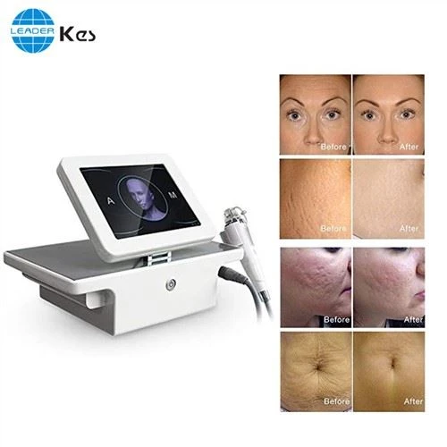 Rf Microneedle Rf Microneedling Machine Salon Notaðu Portable Fractional Rf Face Lifting Microneedle Equipo